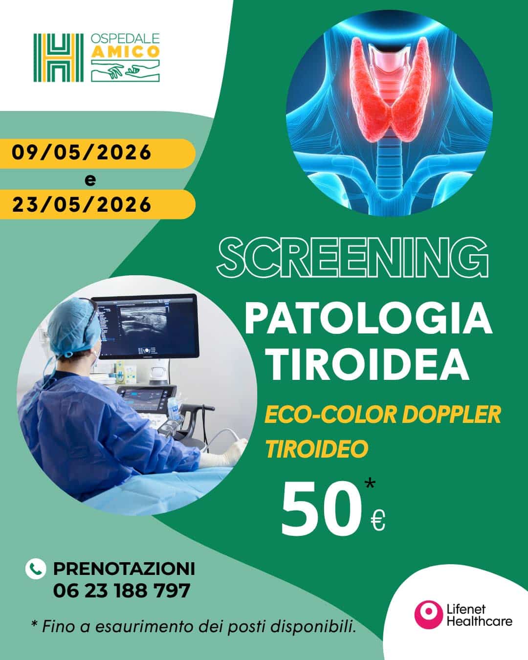 Screening tiroideo: giornate dedicate alla prevenzione 9 e 23 maggio 2026 a roma, policlinico casilino